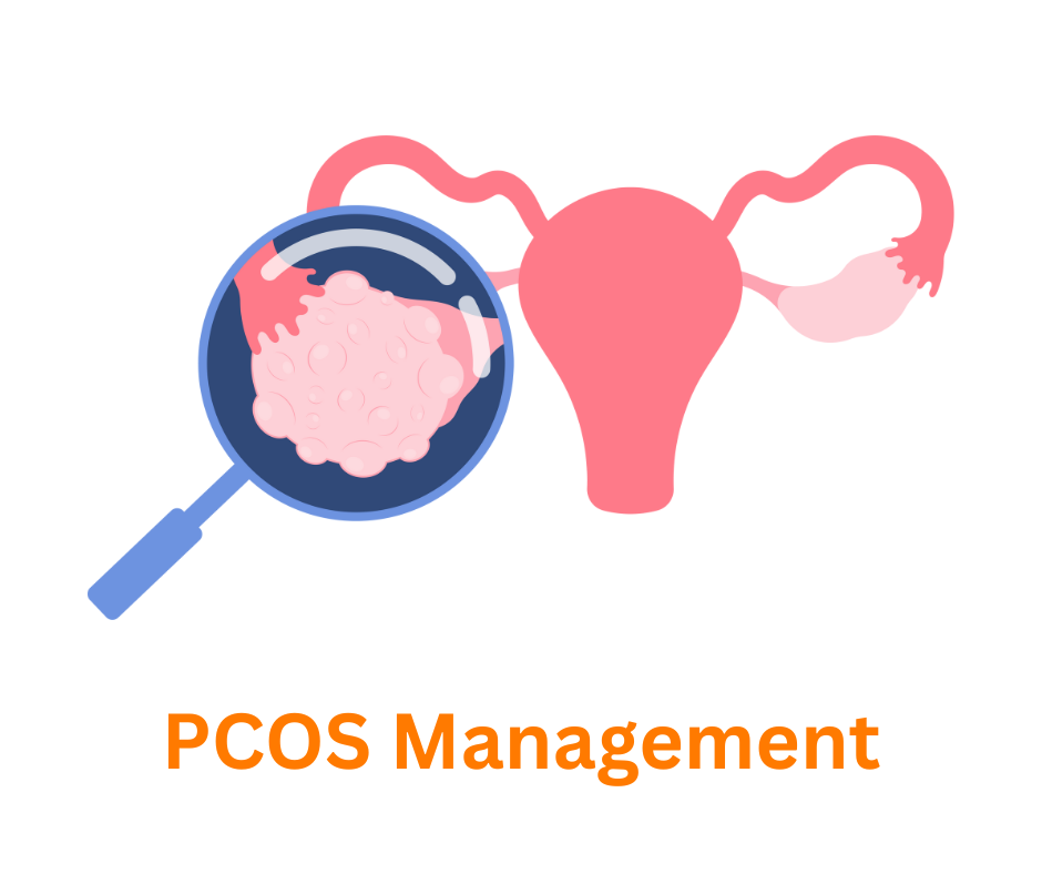 PCOS management